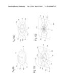 DEVICE FOR REMOVING ACROCHORDONS diagram and image