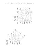 DEVICE FOR REMOVING ACROCHORDONS diagram and image