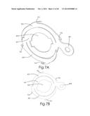 DEVICE AND METHOD FOR DEPLOYING AND ATTACHING AN IMPLANT TO A BIOLOGICAL     TISSUE diagram and image