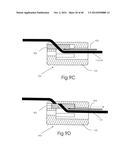 DEVICE AND METHOD FOR DEPLOYING AND ATTACHING AN IMPLANT TO A BIOLOGICAL     TISSUE diagram and image