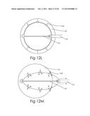 DEVICE AND METHOD FOR DEPLOYING AND ATTACHING AN IMPLANT TO A BIOLOGICAL     TISSUE diagram and image