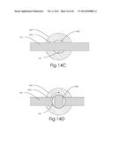 DEVICE AND METHOD FOR DEPLOYING AND ATTACHING AN IMPLANT TO A BIOLOGICAL     TISSUE diagram and image