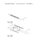 DEVICE AND METHOD FOR DEPLOYING AND ATTACHING AN IMPLANT TO A BIOLOGICAL     TISSUE diagram and image