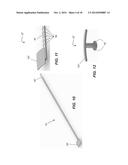 TISSUE DEVICE diagram and image