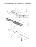 TISSUE DEVICE diagram and image