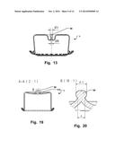 Medical Implant, A Kit And A Method Of Manufacturing A 3D Fabric Of     Strands For Forming A Medical Implant diagram and image