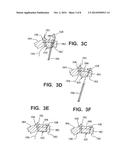 APPARATUS AND METHOD FOR REPAIRING TISSUE diagram and image