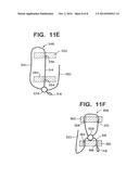 APPARATUS AND METHOD FOR REPAIRING TISSUE diagram and image