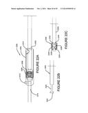 NONINVASIVE DEVICE FOR ADJUSTING FASTENER diagram and image