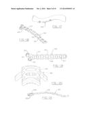 ORTHOPEDIC PLATES FOR USE IN CLAVICLE REPAIR AND METHODS FOR THEIR USE diagram and image