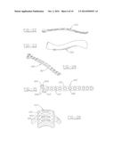 ORTHOPEDIC PLATES FOR USE IN CLAVICLE REPAIR AND METHODS FOR THEIR USE diagram and image