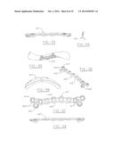 ORTHOPEDIC PLATES FOR USE IN CLAVICLE REPAIR AND METHODS FOR THEIR USE diagram and image