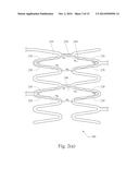 GRADUALLY SELF-EXPANDING STENT diagram and image