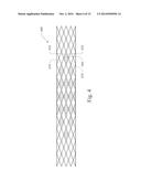 GRADUALLY SELF-EXPANDING STENT diagram and image