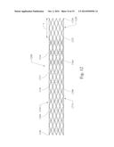 GRADUALLY SELF-EXPANDING STENT diagram and image