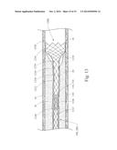 GRADUALLY SELF-EXPANDING STENT diagram and image