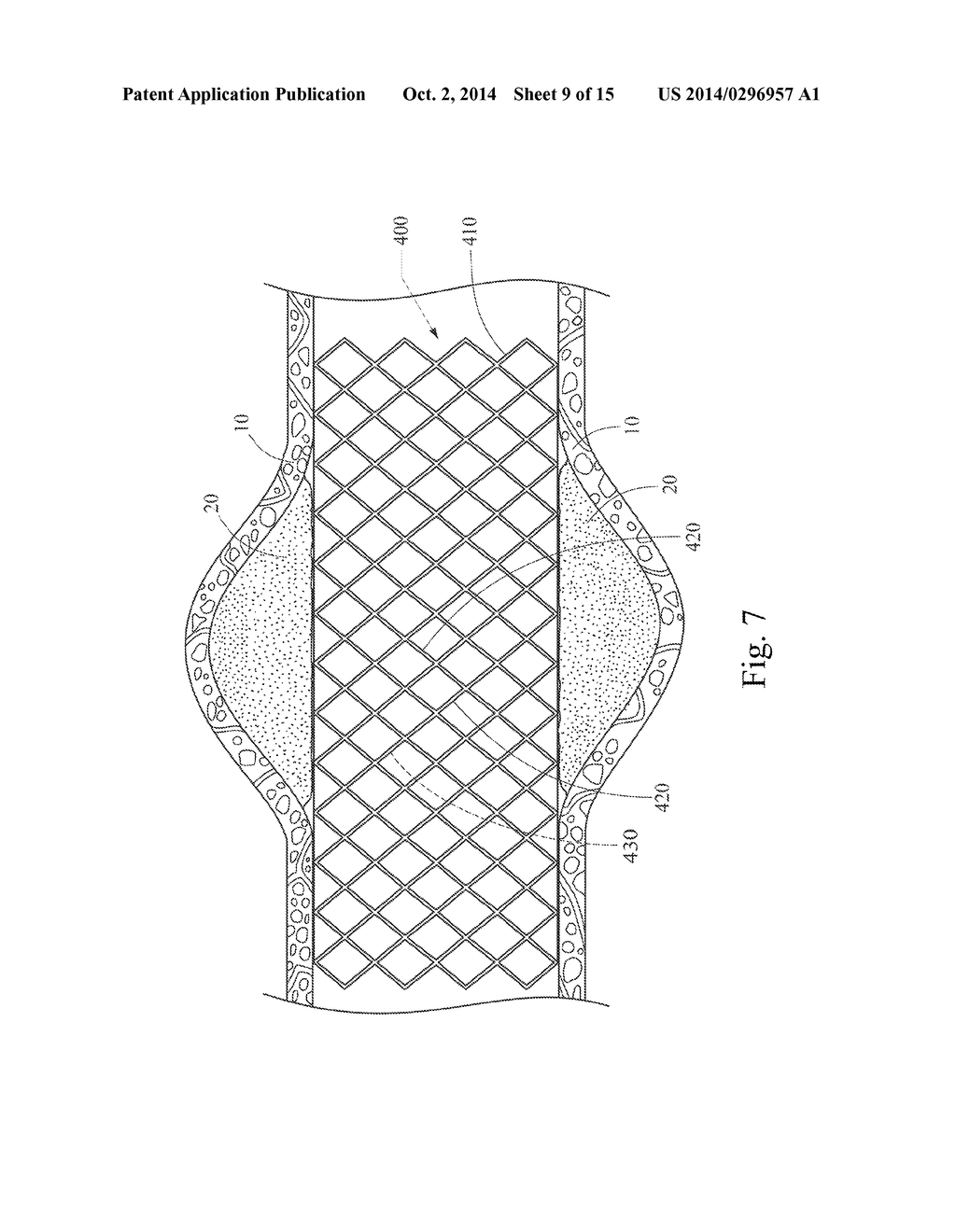 GRADUALLY SELF-EXPANDING STENT - diagram, schematic, and image 10