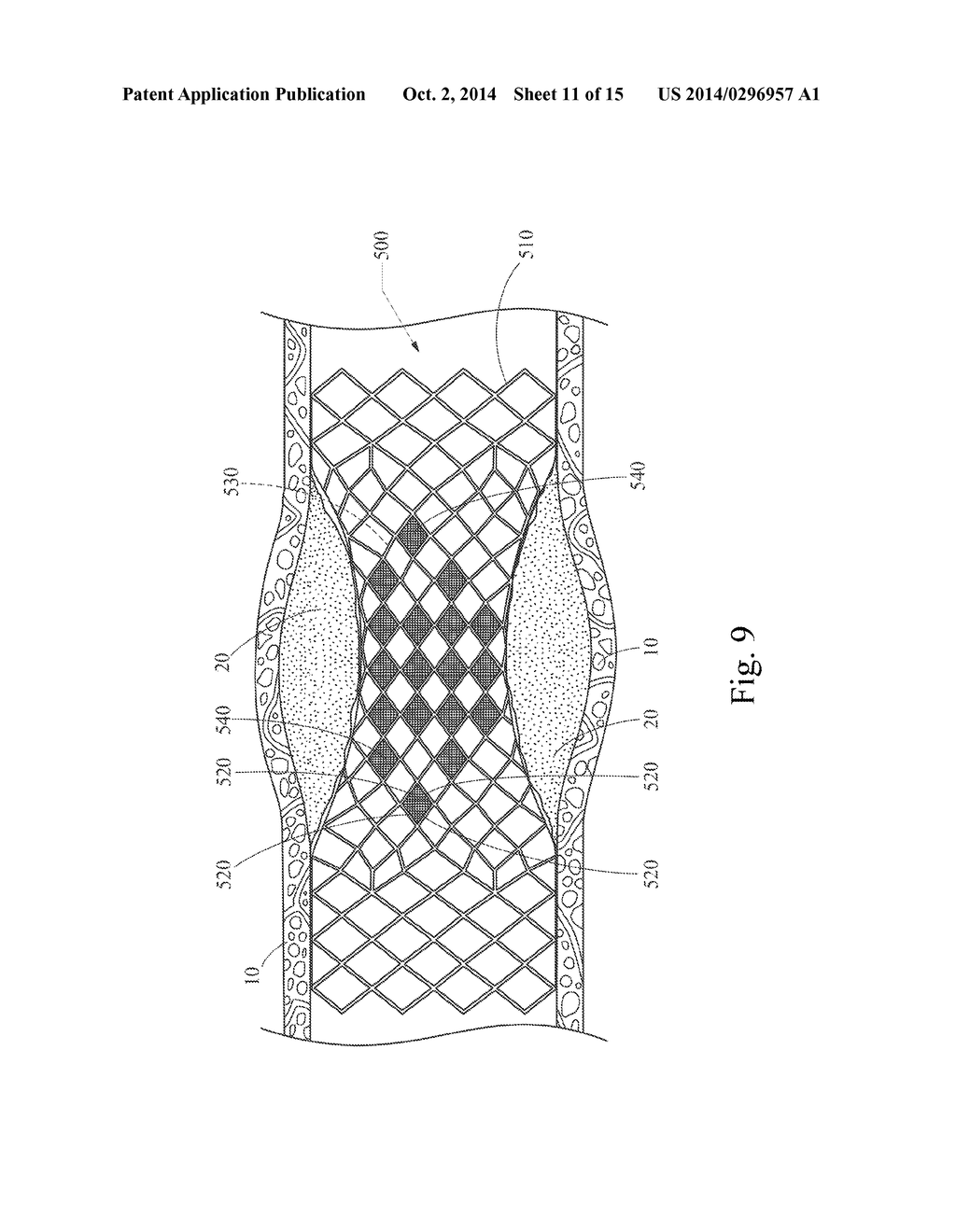 GRADUALLY SELF-EXPANDING STENT - diagram, schematic, and image 12