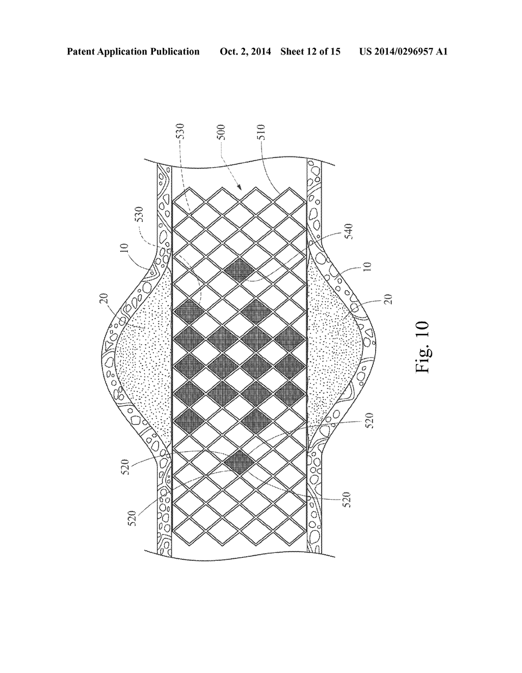 GRADUALLY SELF-EXPANDING STENT - diagram, schematic, and image 13