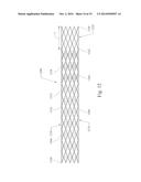 GRADUALLY SELF-EXPANDING STENT diagram and image