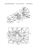 PROSTHESIS HAVING PIVOTING FENESTRATION diagram and image