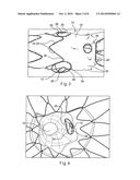 PROSTHESIS HAVING PIVOTING FENESTRATION diagram and image