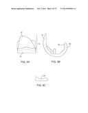 SYSTEMS AND METHODS FOR PROVIDING AN ASYMMETRICAL FEMORAL COMPONENT diagram and image