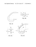 SYSTEMS AND METHODS FOR PROVIDING AN ASYMMETRICAL FEMORAL COMPONENT diagram and image