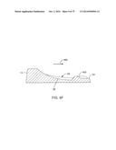 SYSTEMS AND METHODS FOR PROVIDING AN ASYMMETRICAL FEMORAL COMPONENT diagram and image