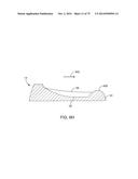 SYSTEMS AND METHODS FOR PROVIDING AN ASYMMETRICAL FEMORAL COMPONENT diagram and image