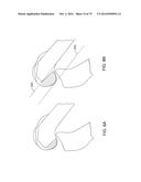 SYSTEMS AND METHODS FOR PROVIDING AN ASYMMETRICAL FEMORAL COMPONENT diagram and image