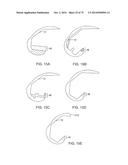 SYSTEMS AND METHODS FOR PROVIDING AN ASYMMETRICAL FEMORAL COMPONENT diagram and image