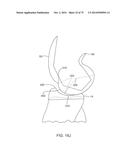 SYSTEMS AND METHODS FOR PROVIDING AN ASYMMETRICAL FEMORAL COMPONENT diagram and image