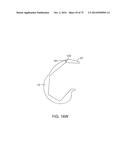 SYSTEMS AND METHODS FOR PROVIDING AN ASYMMETRICAL FEMORAL COMPONENT diagram and image