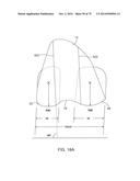 SYSTEMS AND METHODS FOR PROVIDING AN ASYMMETRICAL FEMORAL COMPONENT diagram and image