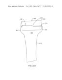 SYSTEMS AND METHODS FOR PROVIDING AN ASYMMETRICAL FEMORAL COMPONENT diagram and image