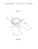 SYSTEMS AND METHODS FOR PROVIDING AN ASYMMETRICAL FEMORAL COMPONENT diagram and image