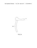 SYSTEMS AND METHODS FOR PROVIDING AN ASYMMETRICAL FEMORAL COMPONENT diagram and image