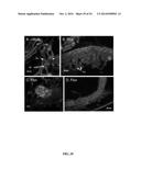 MODIFIED ARTHROPOD AND METHOD OF USE diagram and image