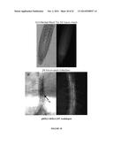 Crop Resistance to Nematodes diagram and image