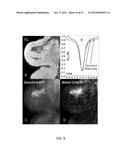 QUANTIFYING BREAST TISSUE CHANGES WITH SPECTRALLY SELECTIVE MRI AND MRS diagram and image