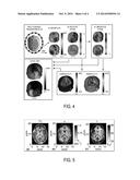 SYSTEMS AND METHODS FOR SPATIAL GRADIENT-BASED ELECTRICAL     PROPERTYPROPERTIES TOMOGRAPHY USING MAGNETIC RESONANCE IMAGING diagram and image