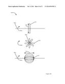 TRUE SPACE TRACKING OF AXISYMMETRIC OBJECT FLIGHT USING DIAMETER     MEASUREMENT diagram and image