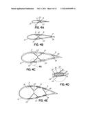 WIND TURBINE BLADES diagram and image