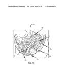 MUCOUS MEMBRANE ACTIVE AGENT APPLICATION diagram and image