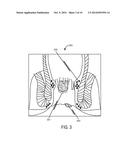 MUCOUS MEMBRANE ACTIVE AGENT APPLICATION diagram and image