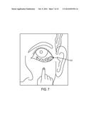 MUCOUS MEMBRANE ACTIVE AGENT APPLICATION diagram and image