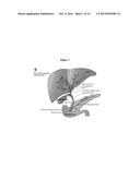 METHOD OF TREATING PANCREATIC AND LIVER CONDITIONS BY ENDOSCOPIC-MEDIATED     (OR LAPAROSCOPIC-MEDIATED) TRANSPLANTATION OF STEM CELLS INTO/ONTO BILE     DUCT WALLS OF PARTICULAR REGIONS OF THE BILIARY TREE diagram and image