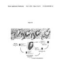 METHOD OF TREATING PANCREATIC AND LIVER CONDITIONS BY ENDOSCOPIC-MEDIATED     (OR LAPAROSCOPIC-MEDIATED) TRANSPLANTATION OF STEM CELLS INTO/ONTO BILE     DUCT WALLS OF PARTICULAR REGIONS OF THE BILIARY TREE diagram and image