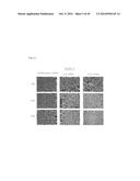 PHARMACEUTICAL COMPOSITION FOR TREATING CANCER USING CARBONATE APATITE     NANOPARTICLES diagram and image